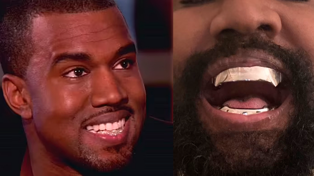 Kanye West con dentadura de Jaws